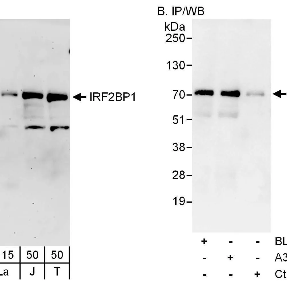 Rabbit anti-IRF2BP1 Antibody, Affinity Purified