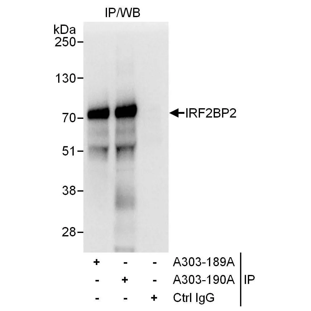 Rabbit anti-IRF2BP2 Antibody, Affinity Purified