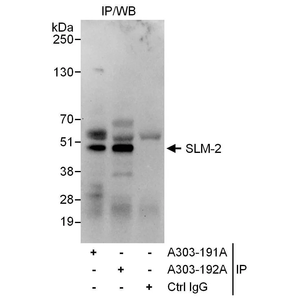 Rabbit anti-SLM-2 Antibody, Affinity Purified