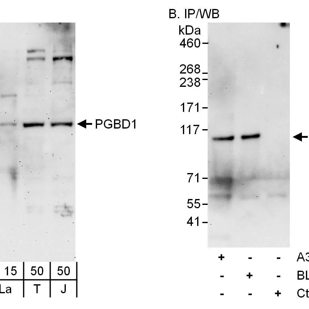 Rabbit anti-PGBD1 Antibody, Affinity Purified
