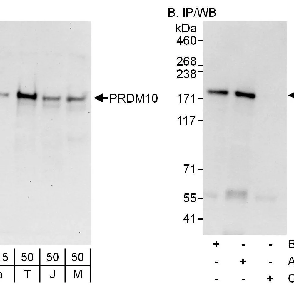Rabbit anti-PRDM10 Antibody, Affinity Purified