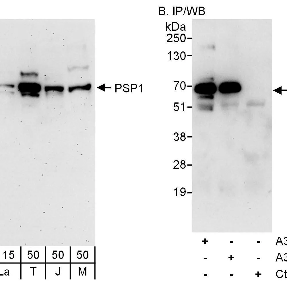 Rabbit anti-PSP1 Antibody, Affinity Purified