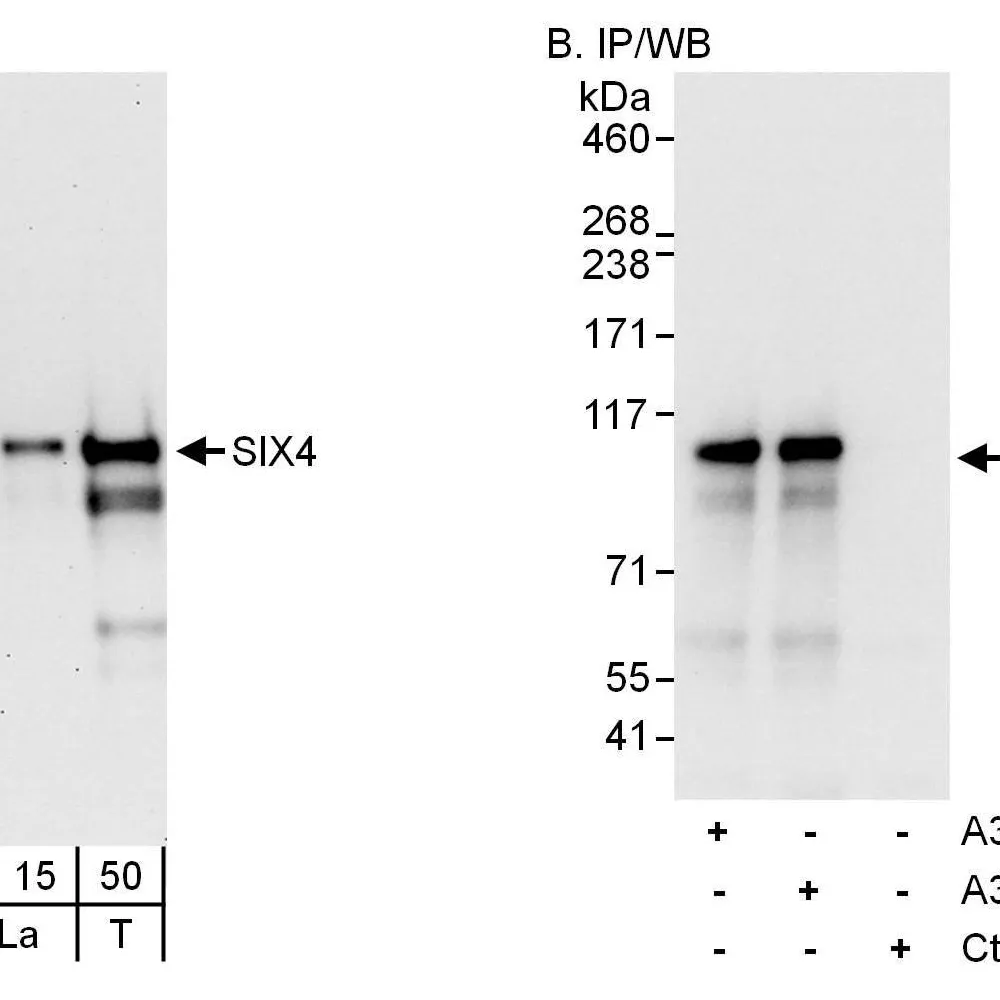 Rabbit anti-SIX4 Antibody, Affinity Purified