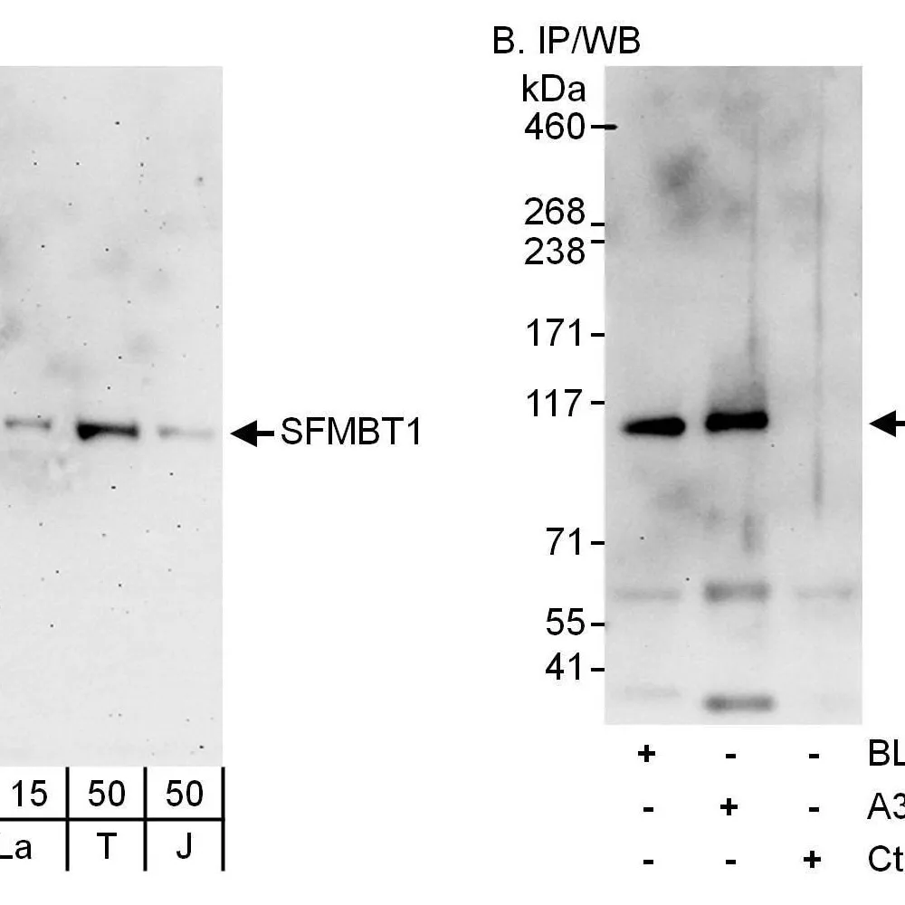Rabbit anti-SFMBT1 Antibody, Affinity Purified