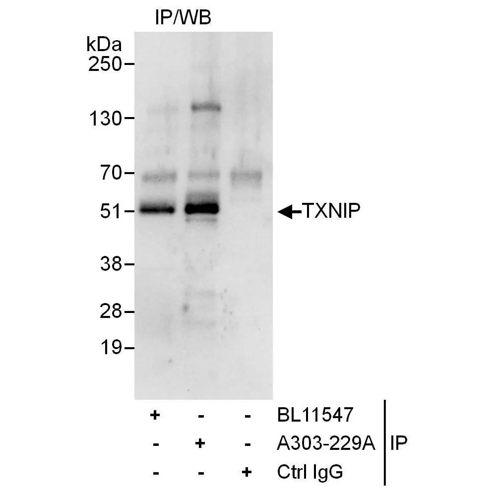 Rabbit anti-TXNIP Antibody, Affinity Purified