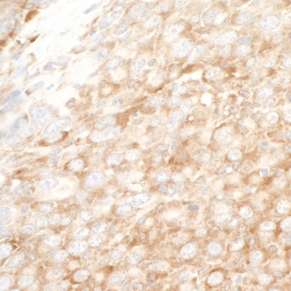 Rabbit anti-YB1 Antibody, Affinity Purified