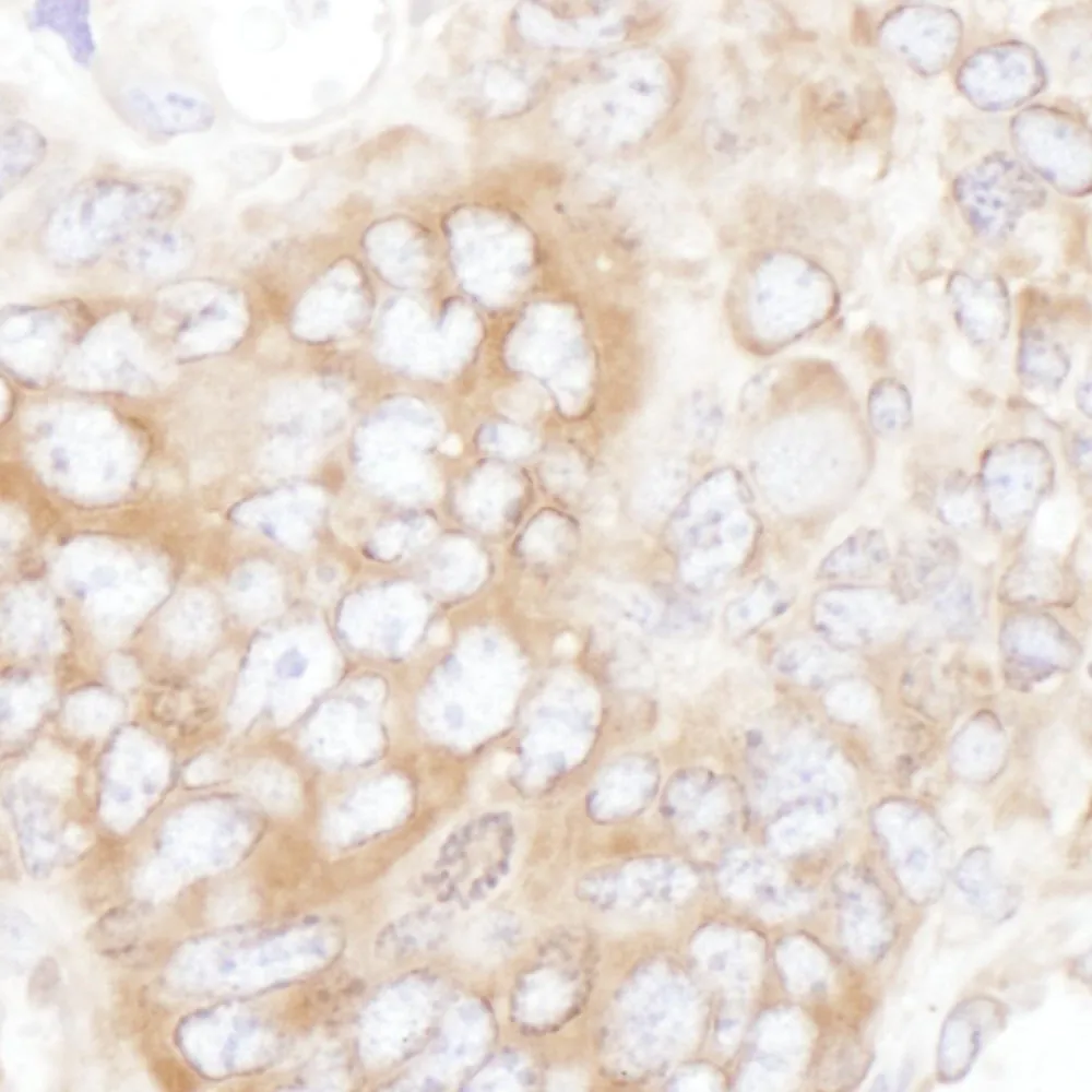 Rabbit anti-YB1 Antibody, Affinity Purified