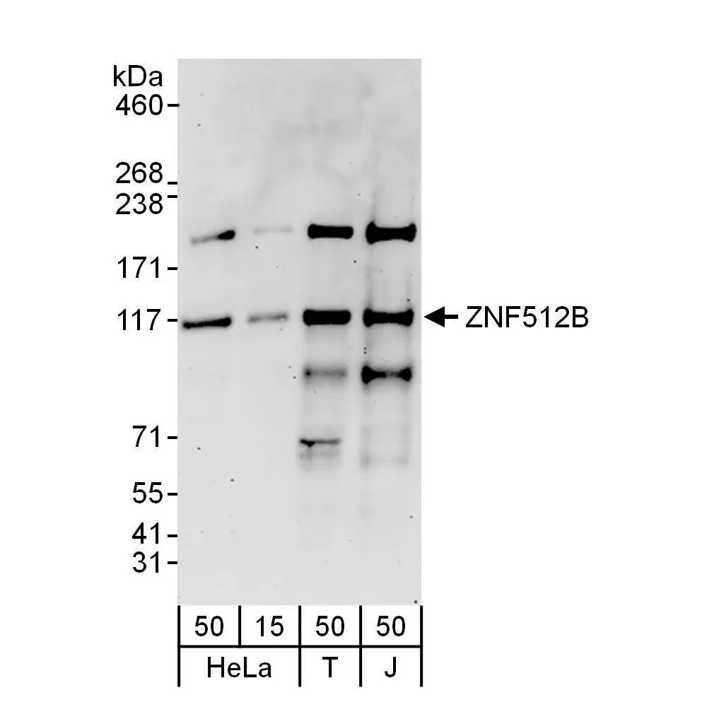 Rabbit anti-ZNF512B Antibody, Affinity Purified