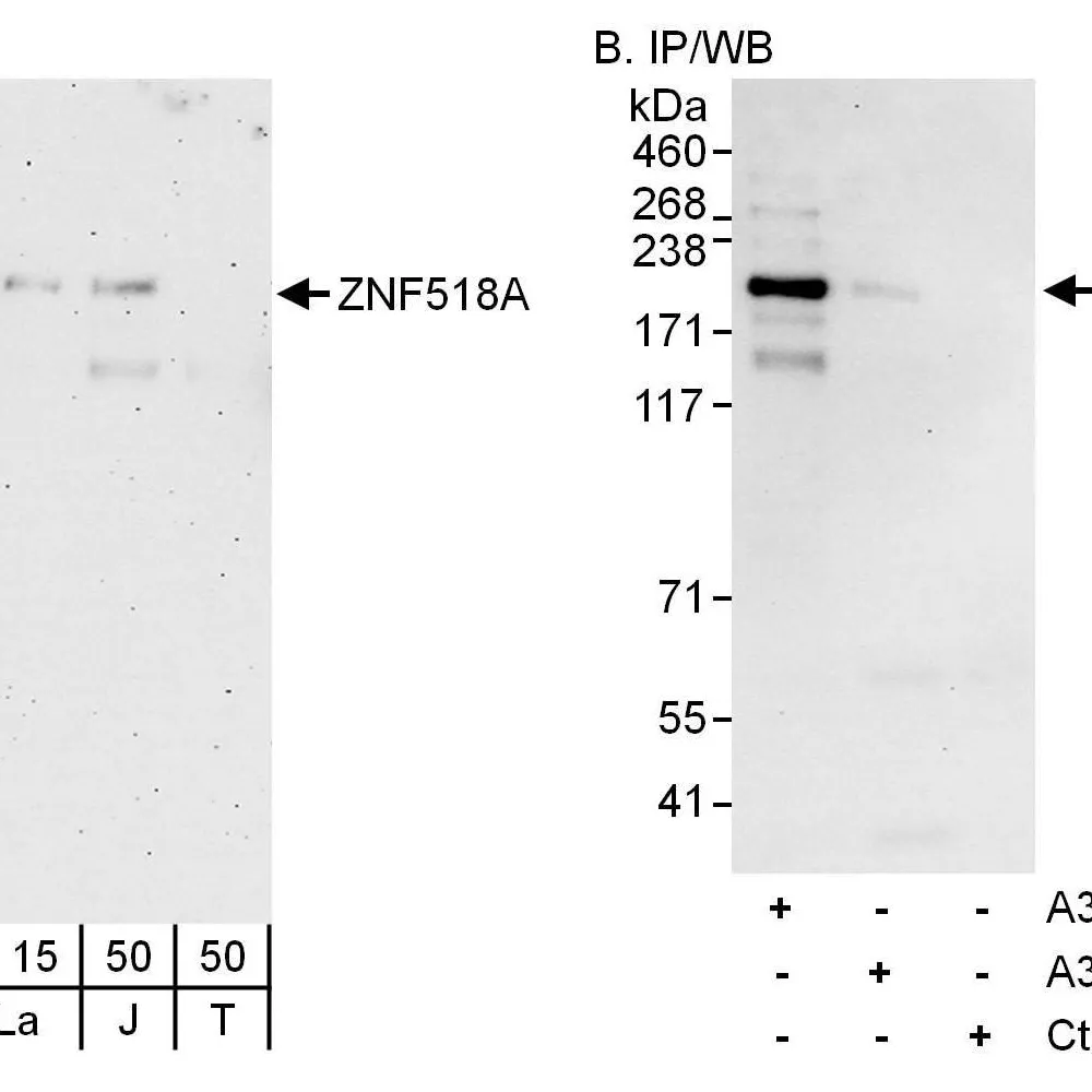 Rabbit anti-ZNF518A Antibody, Affinity Purified