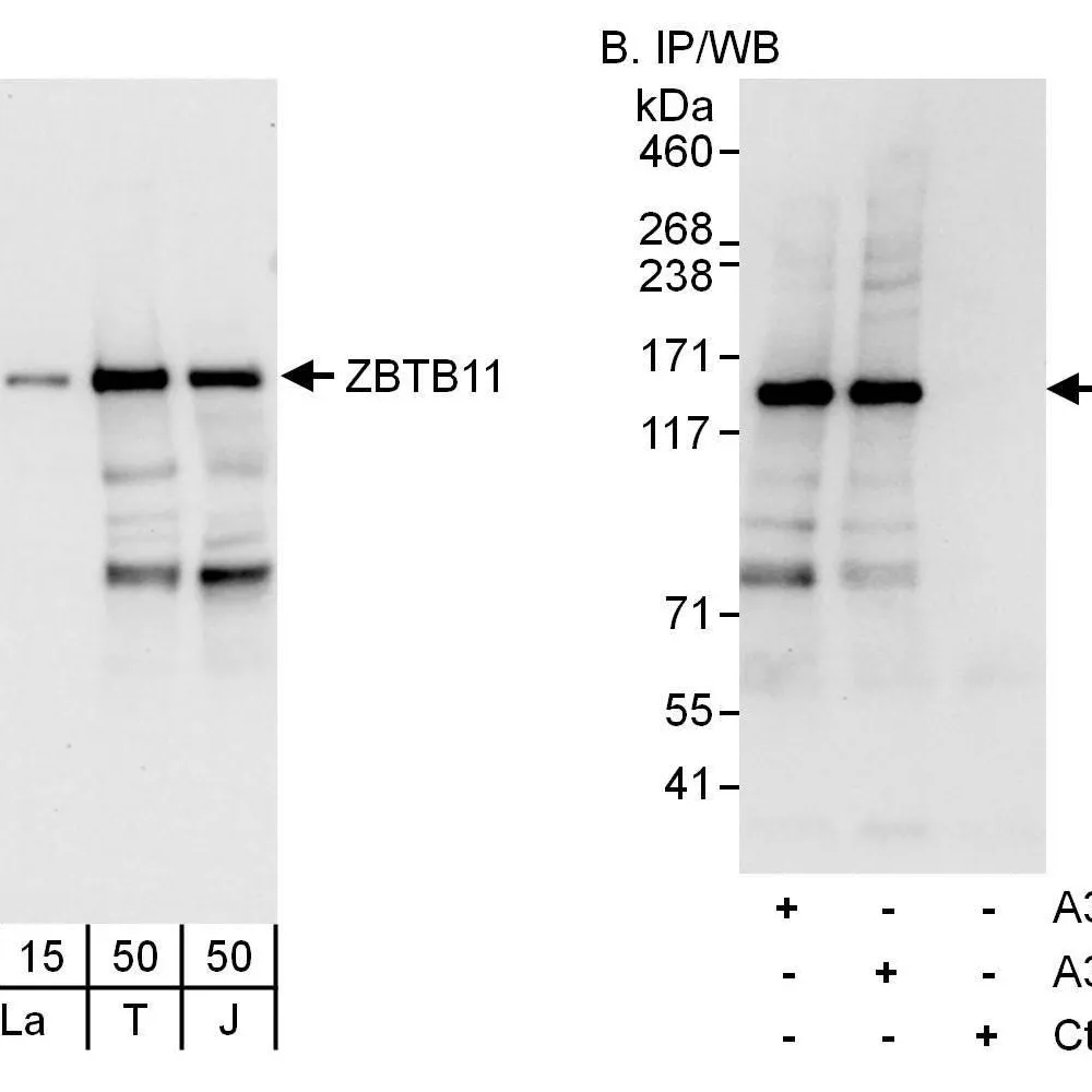 Rabbit anti-ZBTB11 Antibody, Affinity Purified