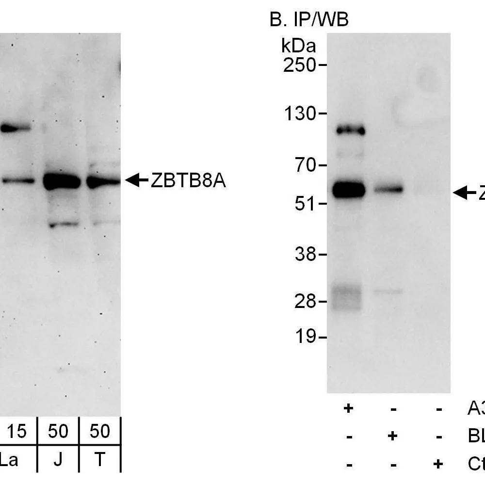 Rabbit anti-ZBTB8A Antibody, Affinity Purified