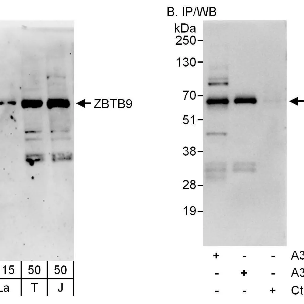 Rabbit anti-ZBTB9 Antibody, Affinity Purified