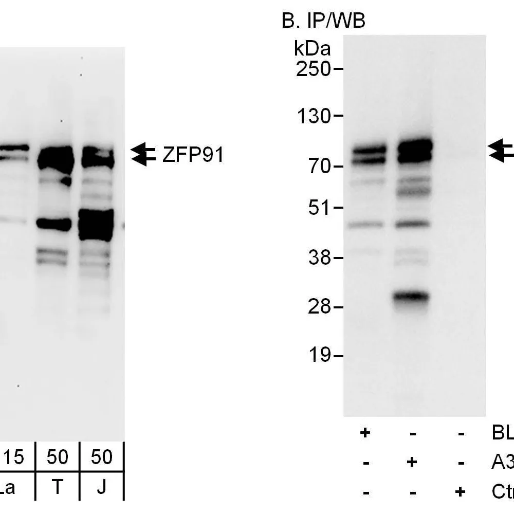 Rabbit anti-ZFP91 Antibody, Affinity Purified