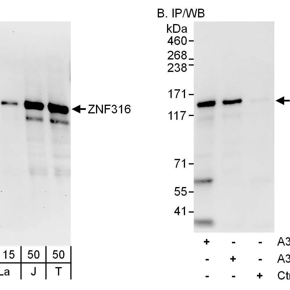 Rabbit anti-ZNF316 Antibody, Affinity Purified