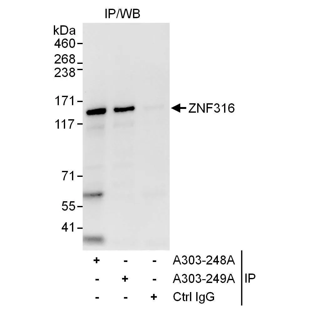 Rabbit anti-ZNF316 Antibody, Affinity Purified