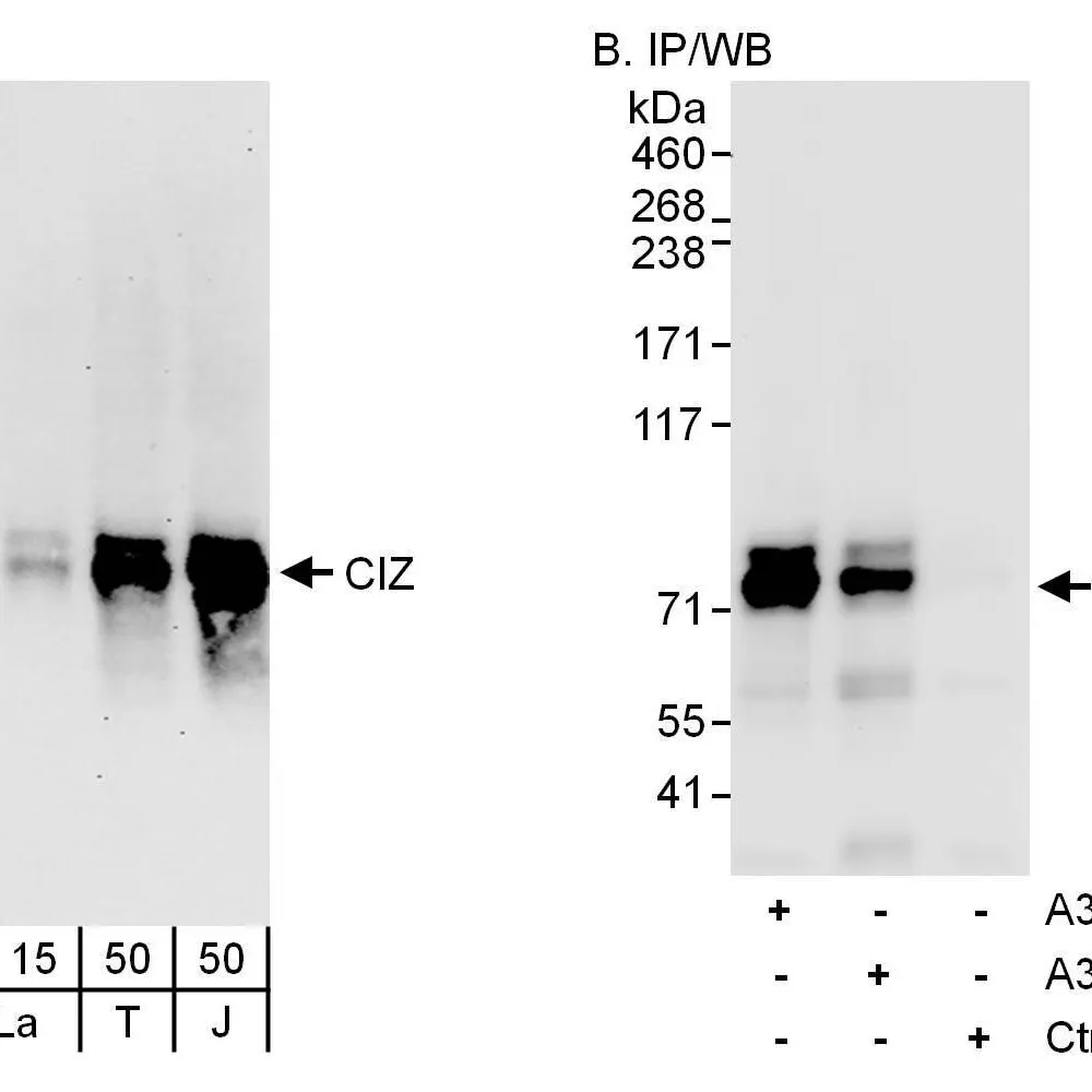 Rabbit anti-CIZ Antibody, Affinity Purified