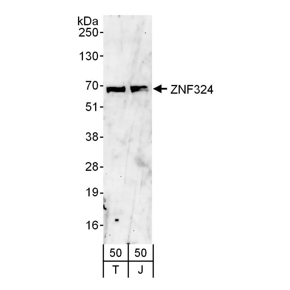 Rabbit anti-ZNF324 Antibody, Affinity Purified