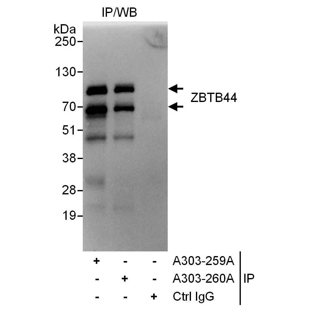 Rabbit anti-ZBTB44 Antibody, Affinity Purified