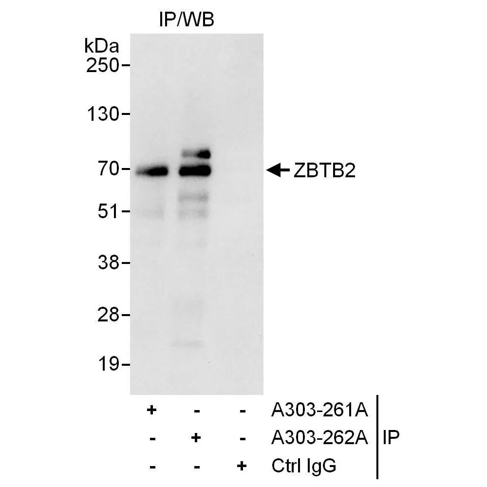 Rabbit anti-ZBTB2 Antibody, Affinity Purified