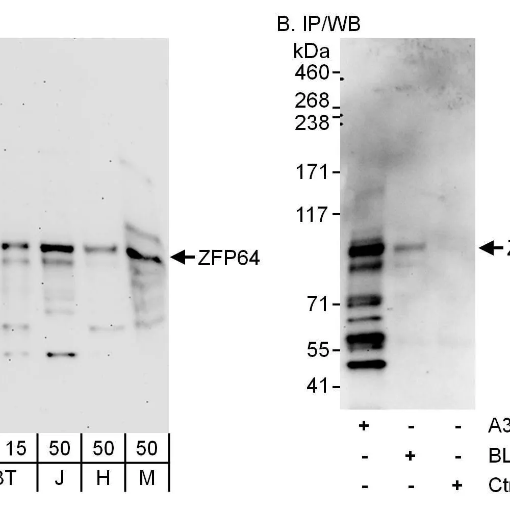 Rabbit anti-ZFP64 Antibody, Affinity Purified