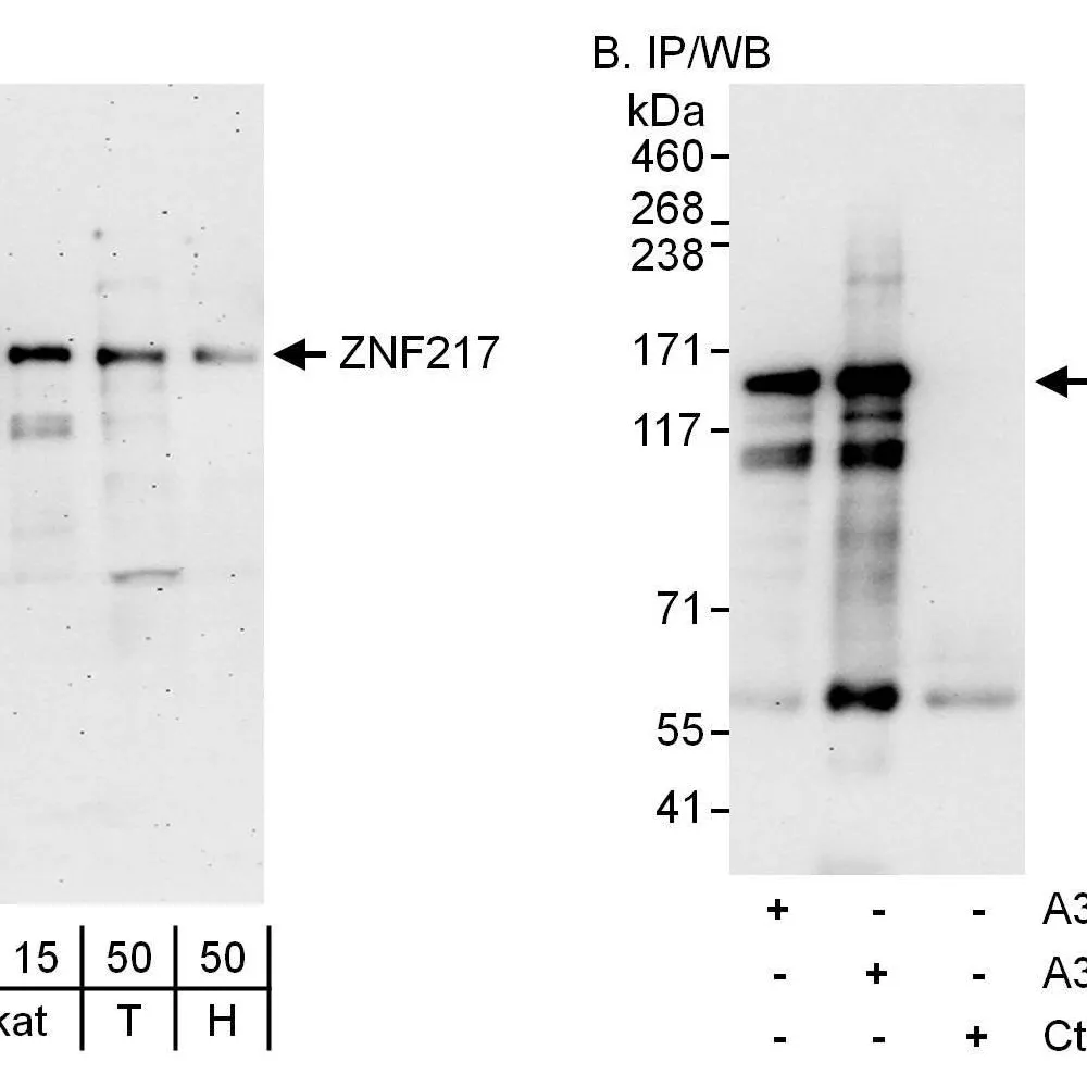 Rabbit anti-ZNF217 Antibody, Affinity Purified