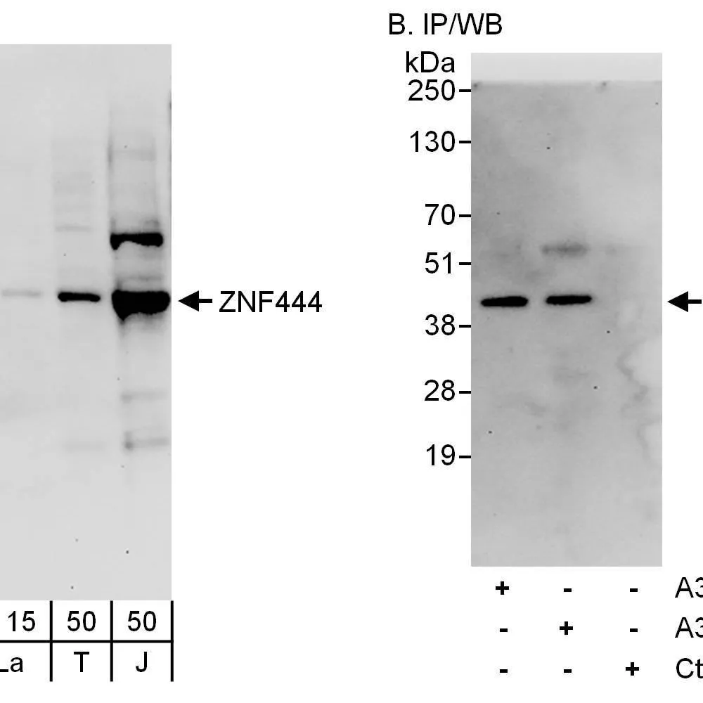 Rabbit anti-ZNF444 Antibody, Affinity Purified