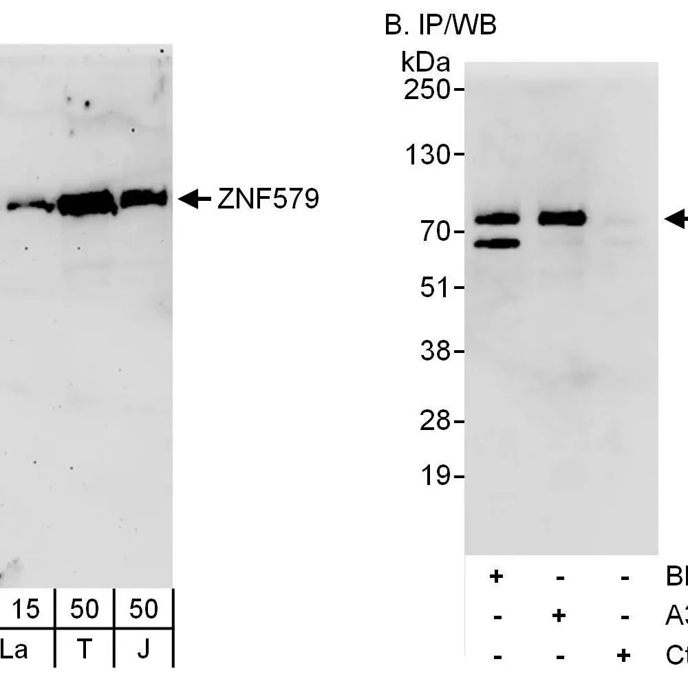 Rabbit anti-ZNF579 Antibody, Affinity Purified