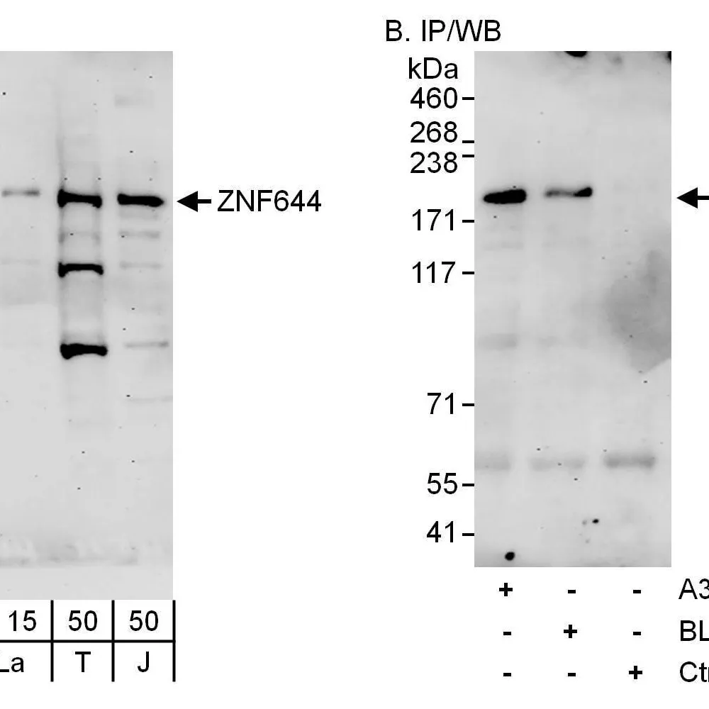 Rabbit anti-ZNF644 Antibody, Affinity Purified