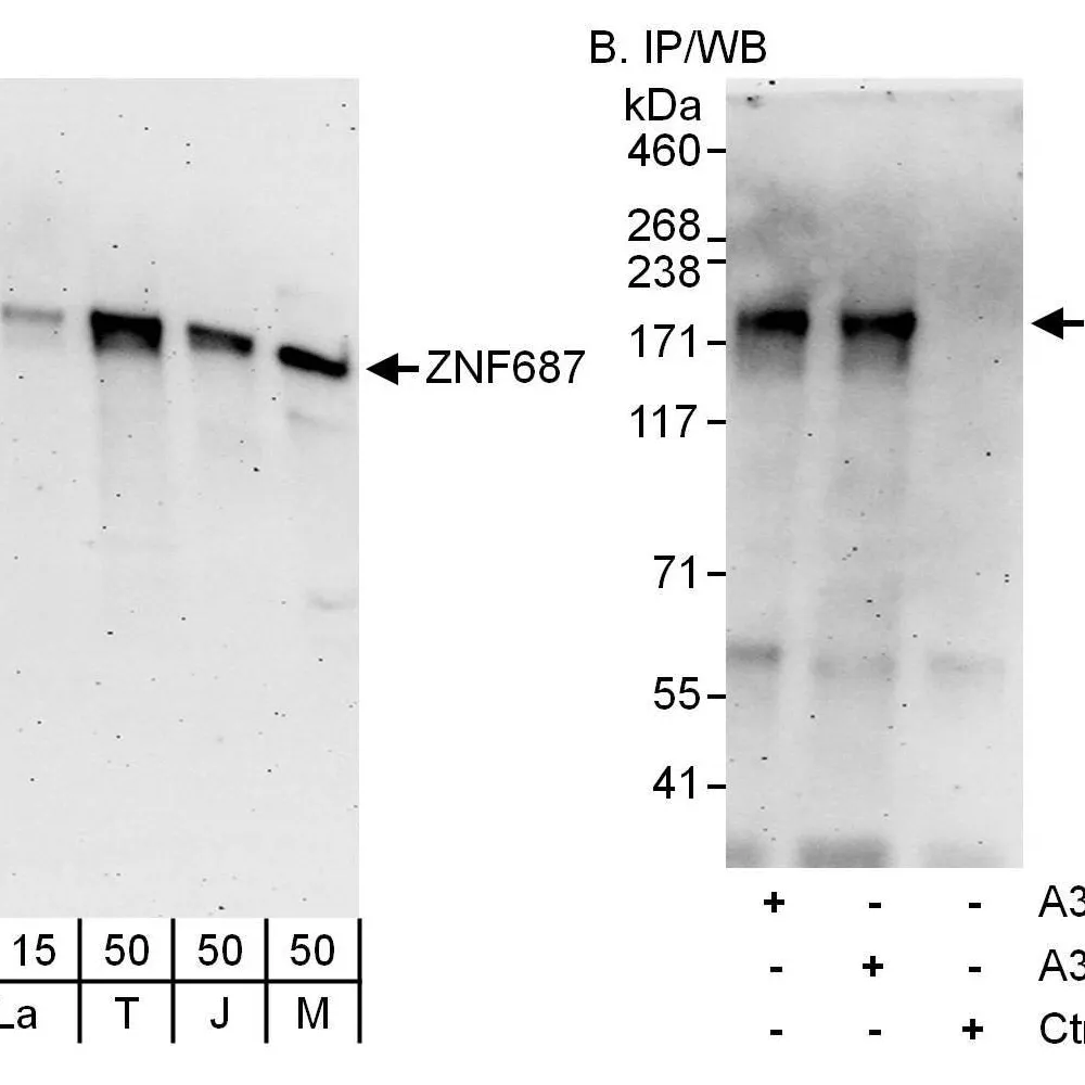 Rabbit anti-ZNF687 Antibody, Affinity Purified