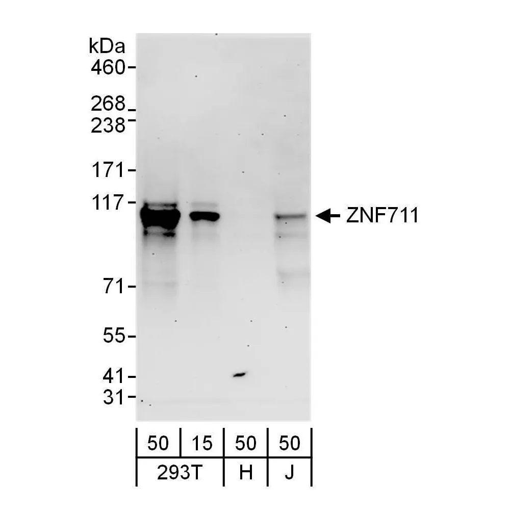 Rabbit anti-ZNF711 Antibody, Affinity Purified