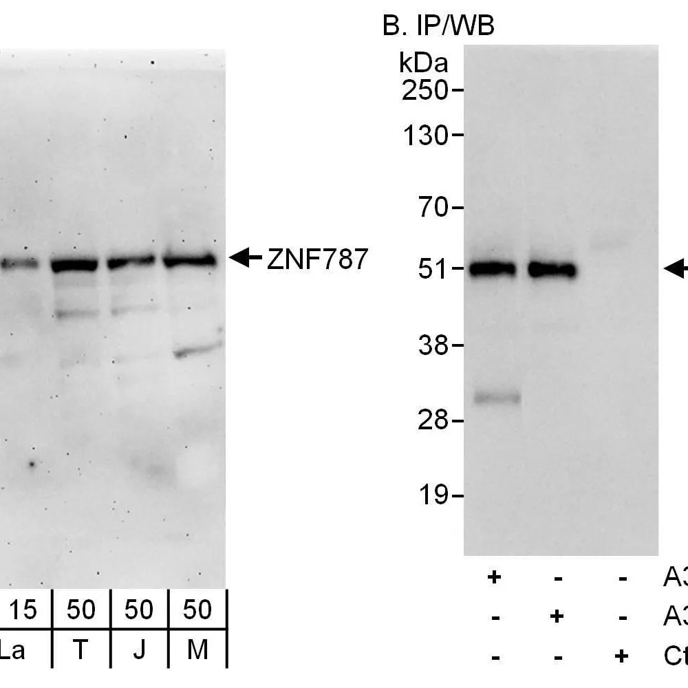 Rabbit anti-ZNF787 Antibody, Affinity Purified