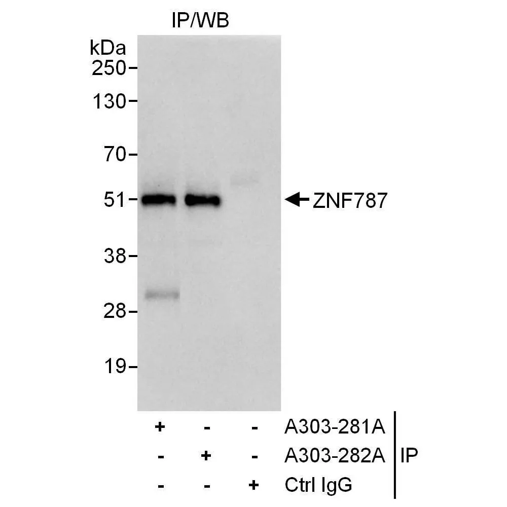 Rabbit anti-ZNF787 Antibody, Affinity Purified