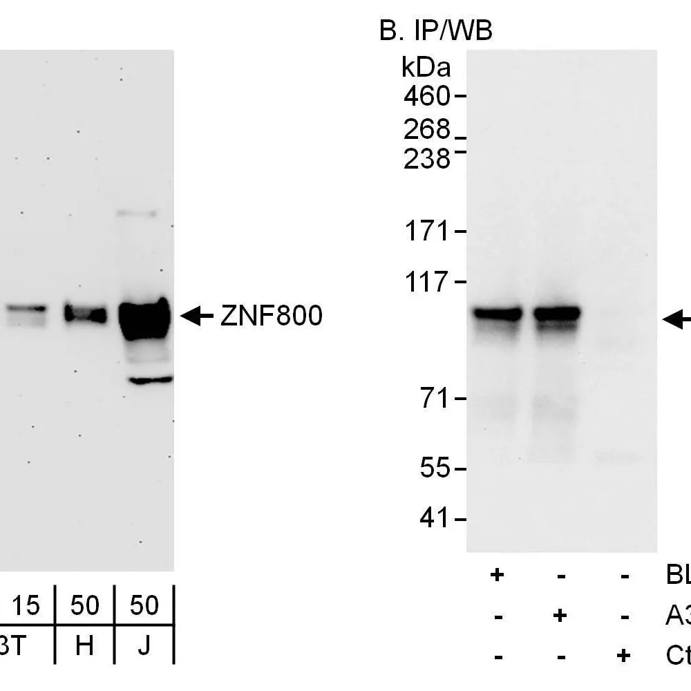 Rabbit anti-ZNF800 Antibody, Affinity Purified