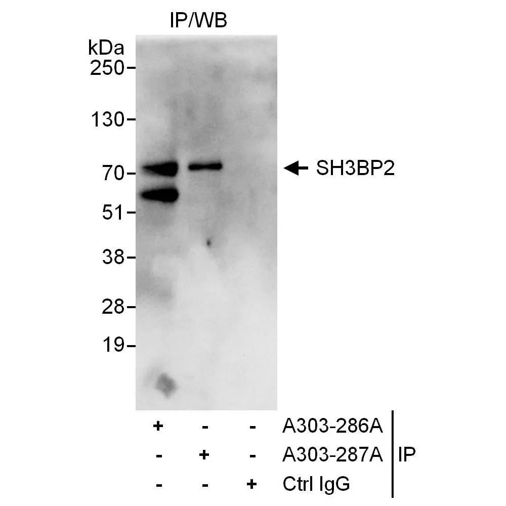 Rabbit anti-SH3BP2 Antibody, Affinity Purified