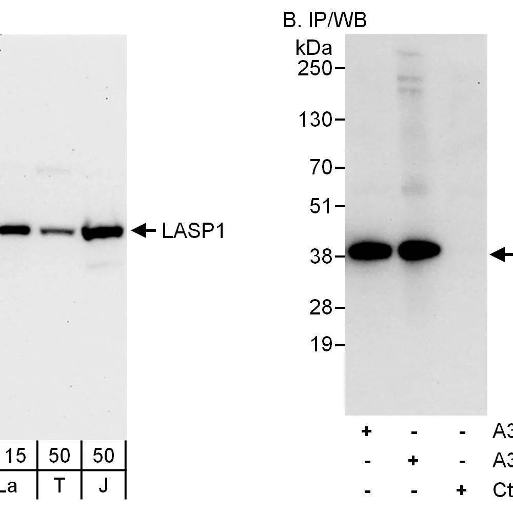 Rabbit anti-LASP1 Antibody, Affinity Purified
