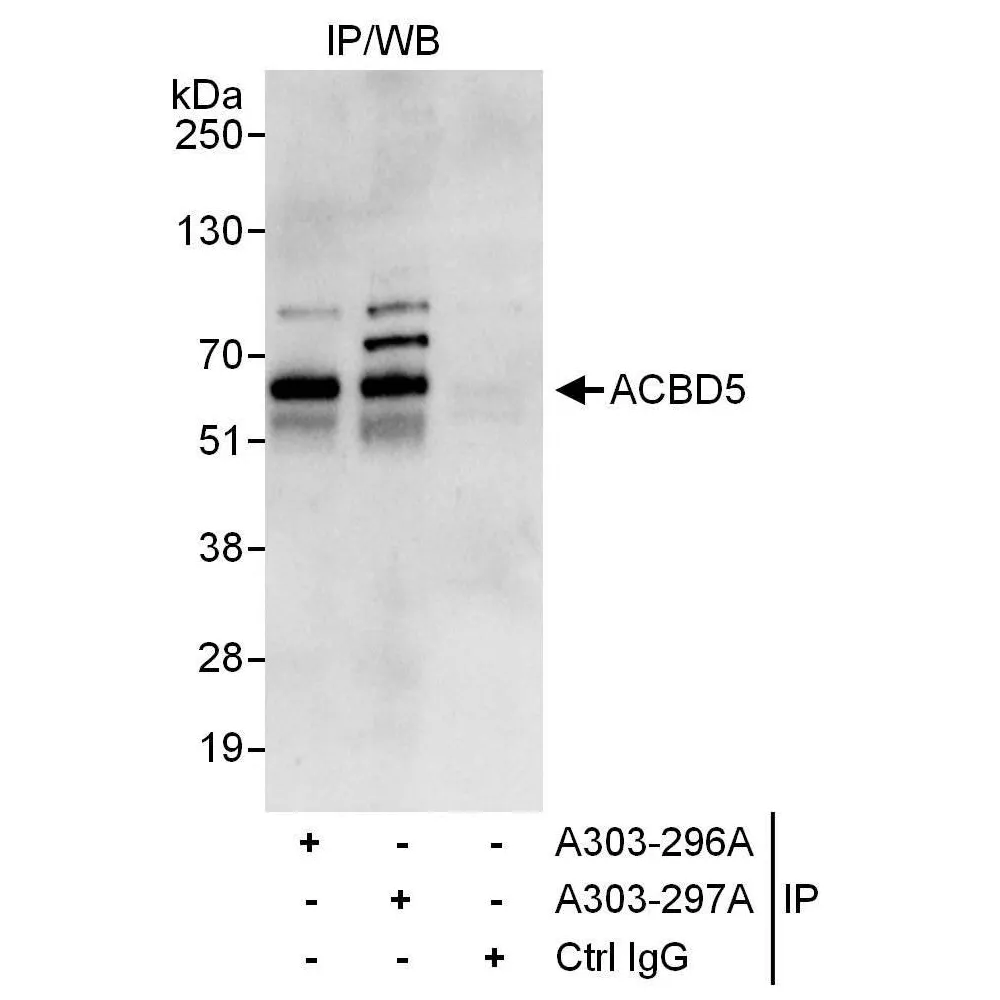 Rabbit anti-ACBD5 Antibody, Affinity Purified