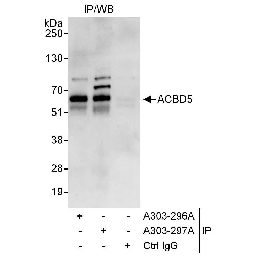 Rabbit anti-ACBD5 Antibody, Affinity Purified