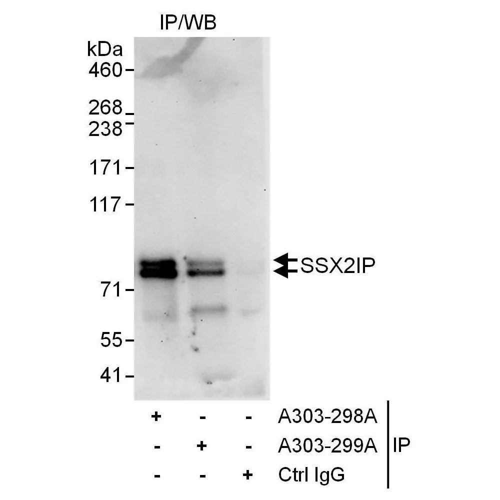 Rabbit anti-SSX2IP Antibody, Affinity Purified