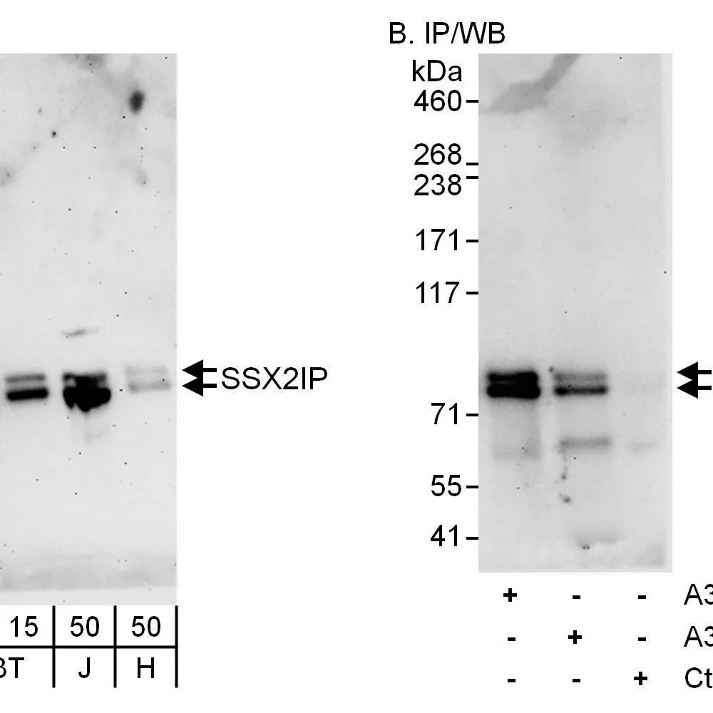 Rabbit anti-SSX2IP Antibody, Affinity Purified