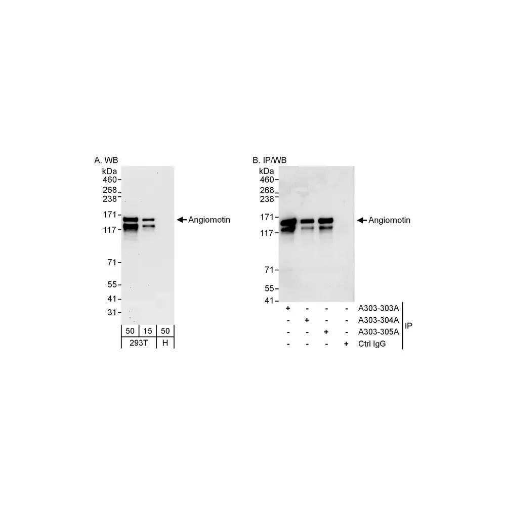 Rabbit anti-Angiomotin Antibody, Affinity Purified