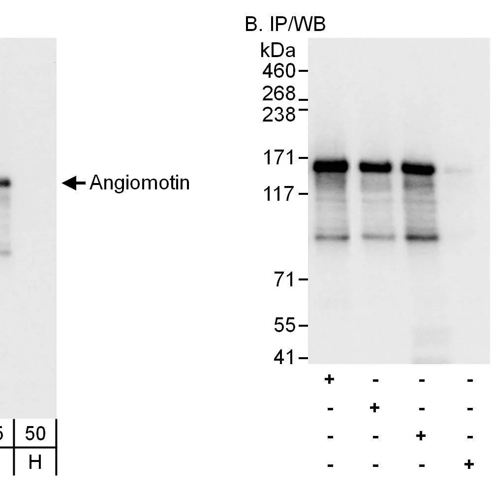 Rabbit anti-Angiomotin Antibody, Affinity Purified