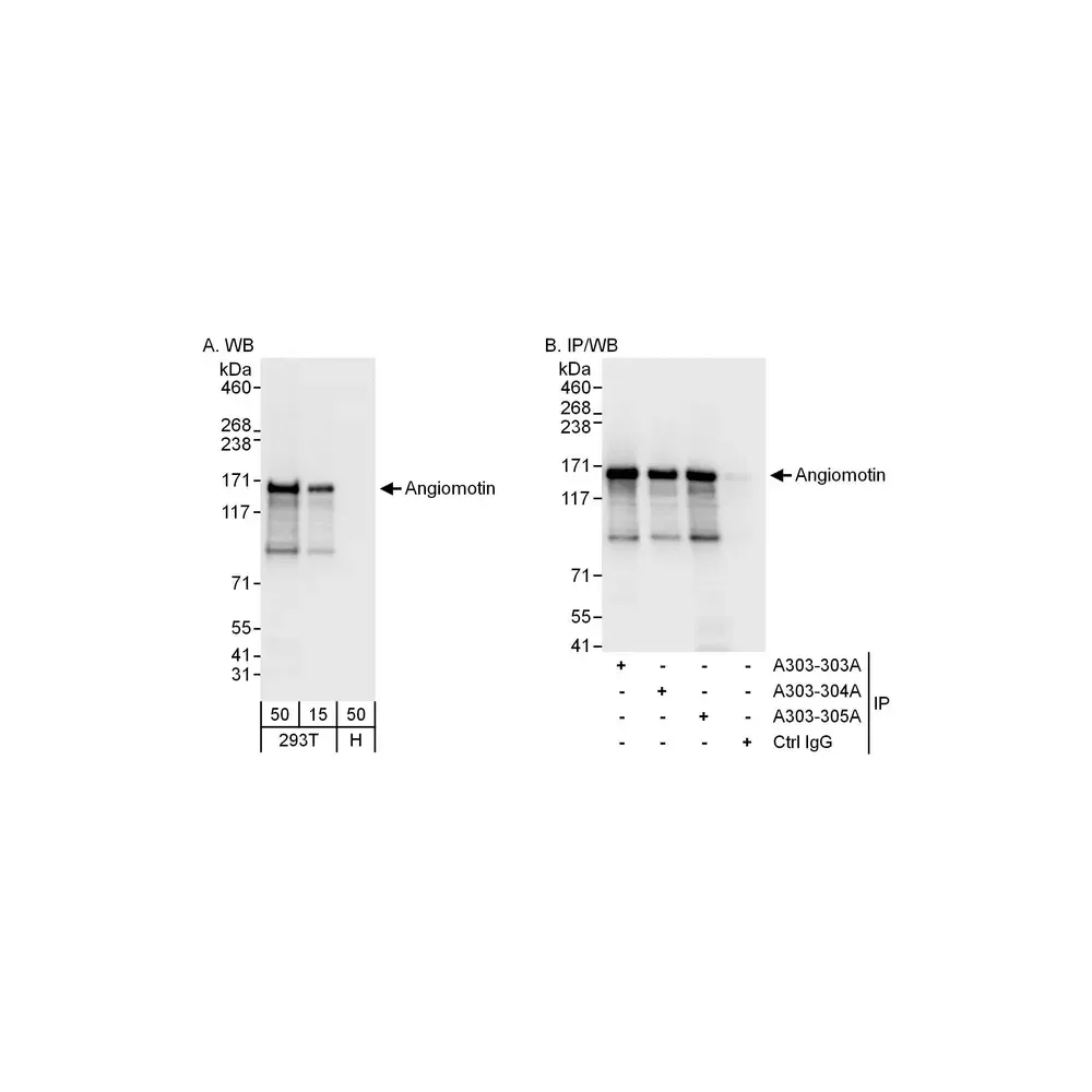 Rabbit anti-Angiomotin Antibody, Affinity Purified