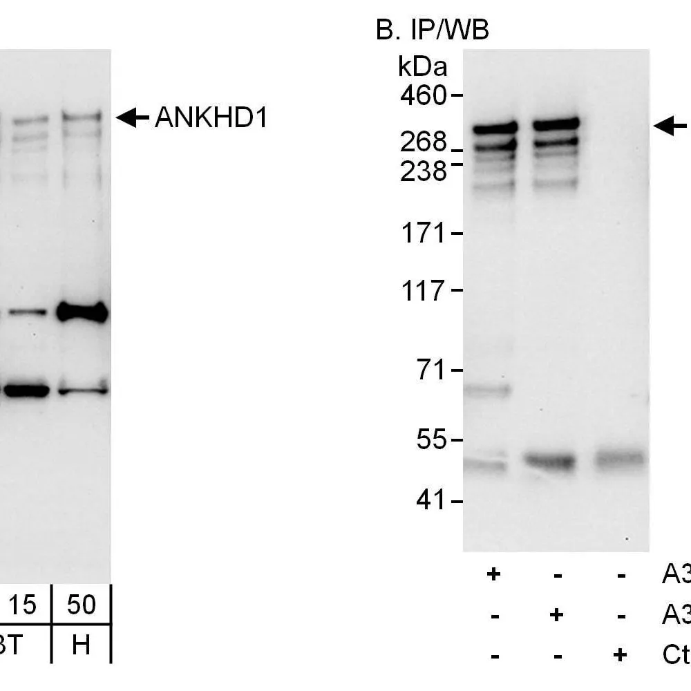 Rabbit anti-ANKHD1 Antibody, Affinity Purified