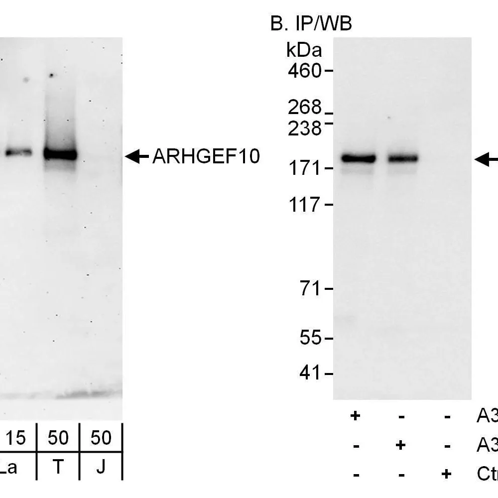 Rabbit anti-ARHGEF10 Antibody, Affinity Purified