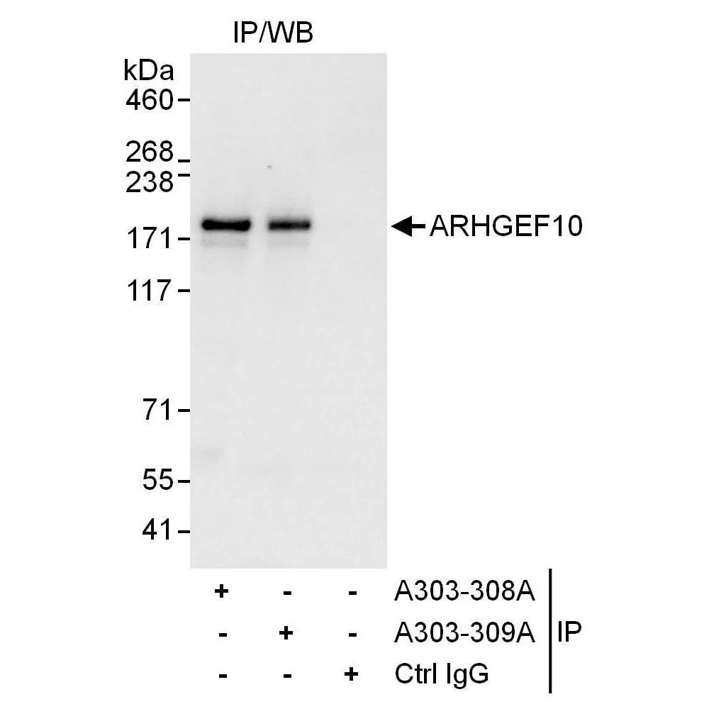 Rabbit anti-ARHGEF10 Antibody, Affinity Purified