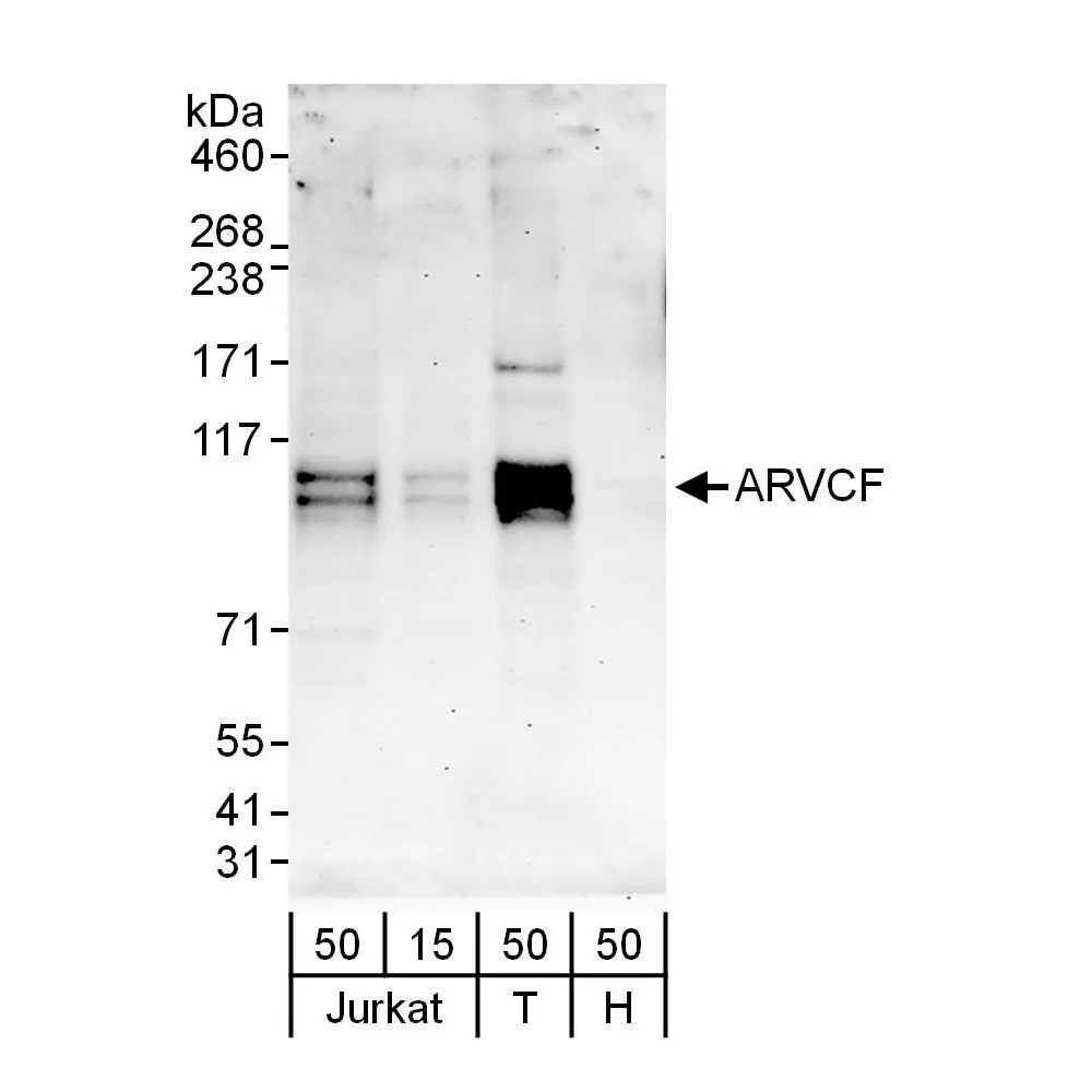 Rabbit anti-ARVCF Antibody, Affinity Purified