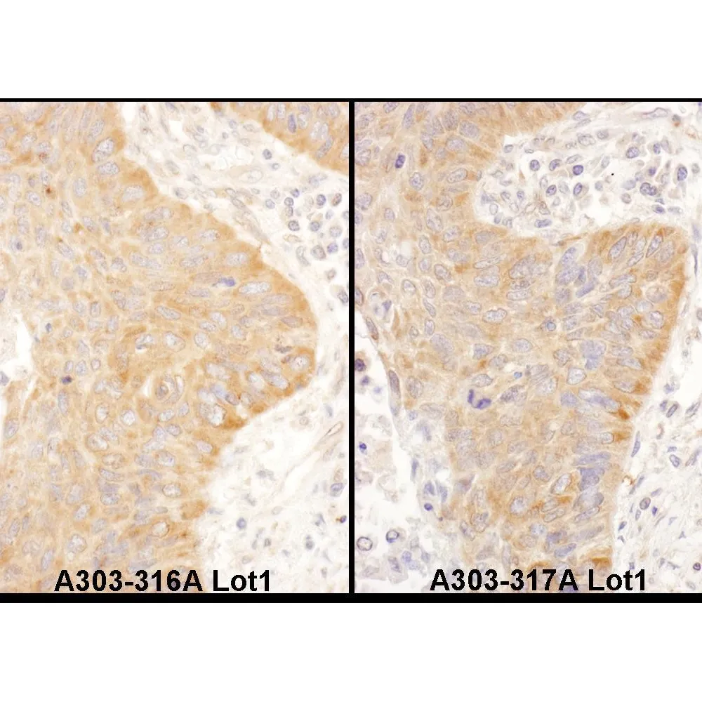 Rabbit anti-IGF2BP2 Antibody, Affinity Purified