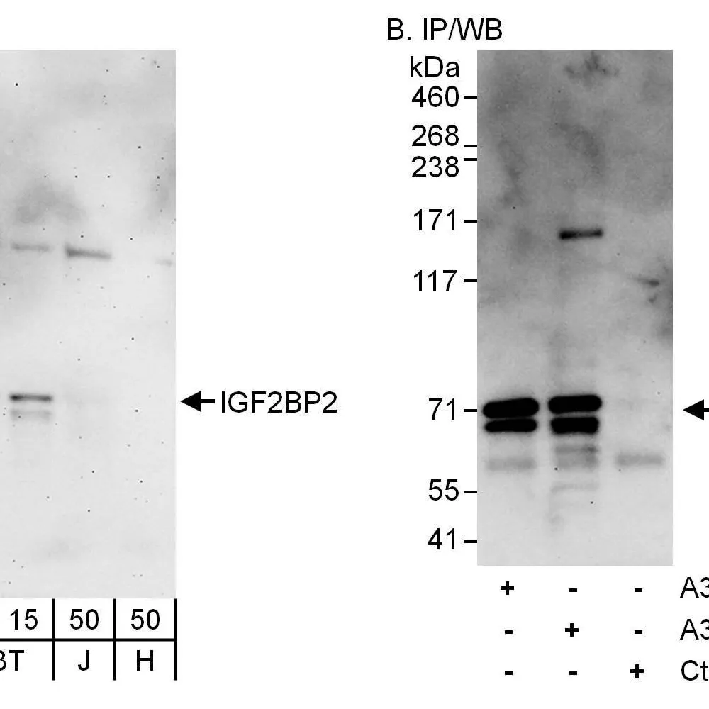 Rabbit anti-IGF2BP2 Antibody, Affinity Purified