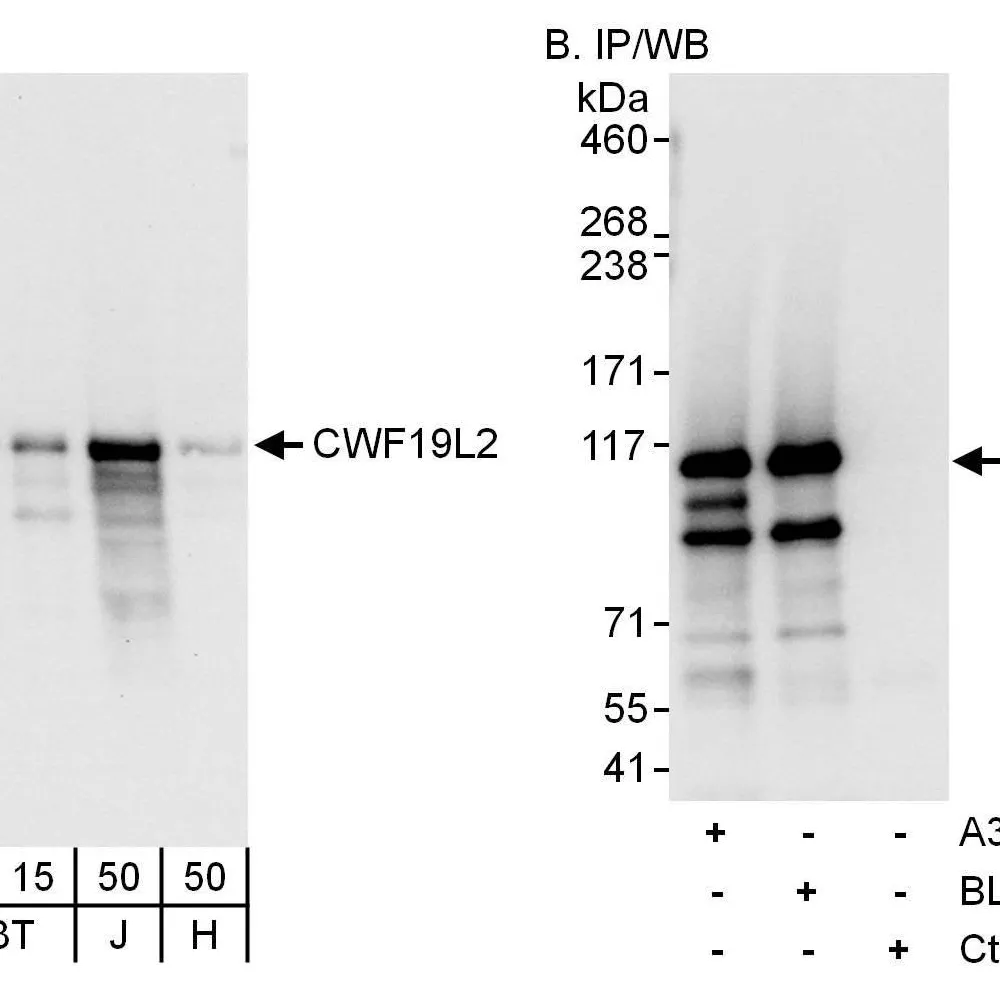 Rabbit anti-CWF19L2 Antibody, Affinity Purified