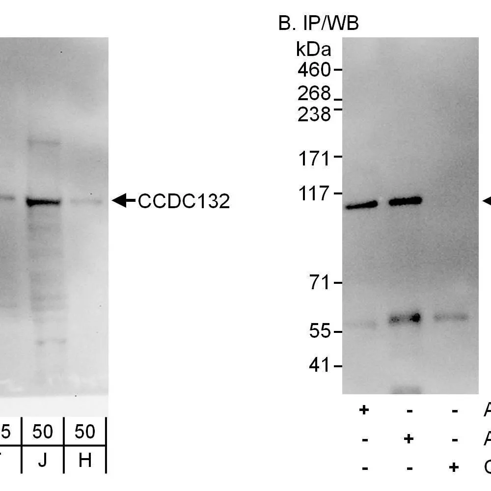 Rabbit anti-CCDC132 Antibody, Affinity Purified